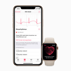 Apple Watch Atrial Fibrillation